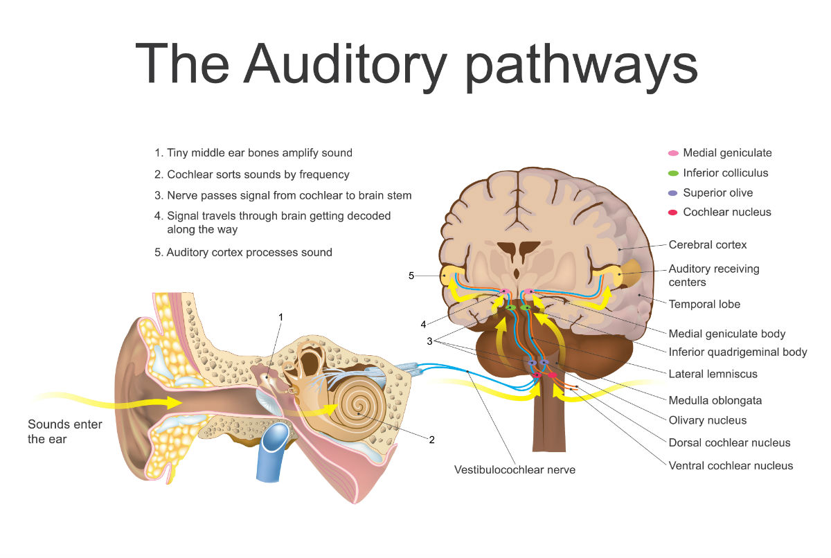 And Others Title Auditory Training