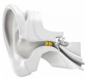 hearing aid solutions