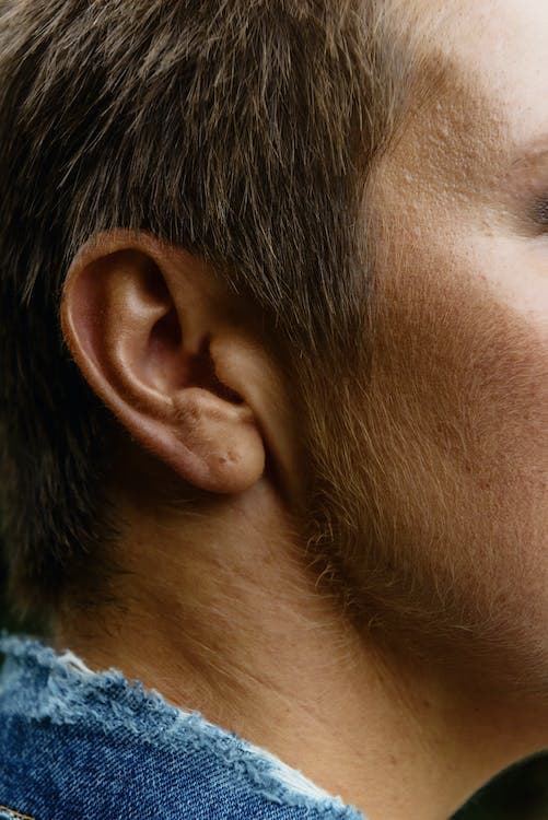 nerve deafness hearing loss